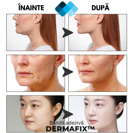 Benzi de lifting facial cu efect natural „Buena Cara” l BeautySide™